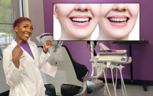 Dental Expert Warns Against DIY Chipped Tooth Repairs in New Article